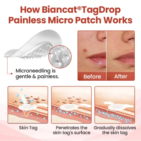 Biancat® TagDrop Painless Micro Patch